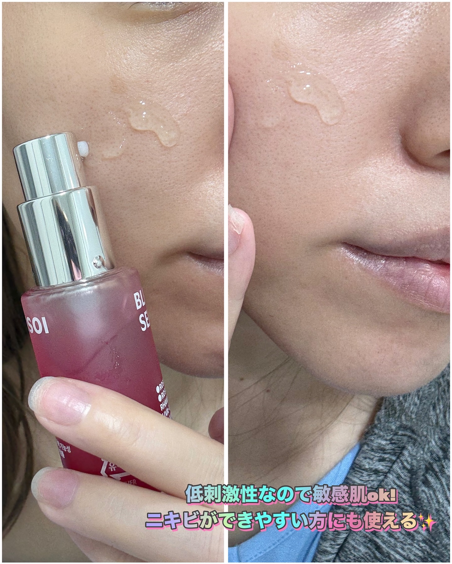 ブレミッシュケアアップ セラム/ISOI/美容液を使ったクチコミ（3枚目）