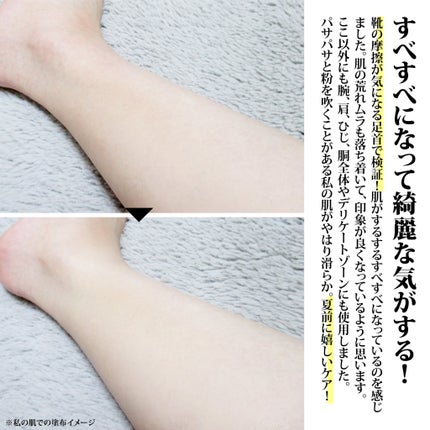 BnDアンダーアームクリーム(ボディクリーム)/BnD/デリケートゾーンケアを使ったクチコミ(4枚目)