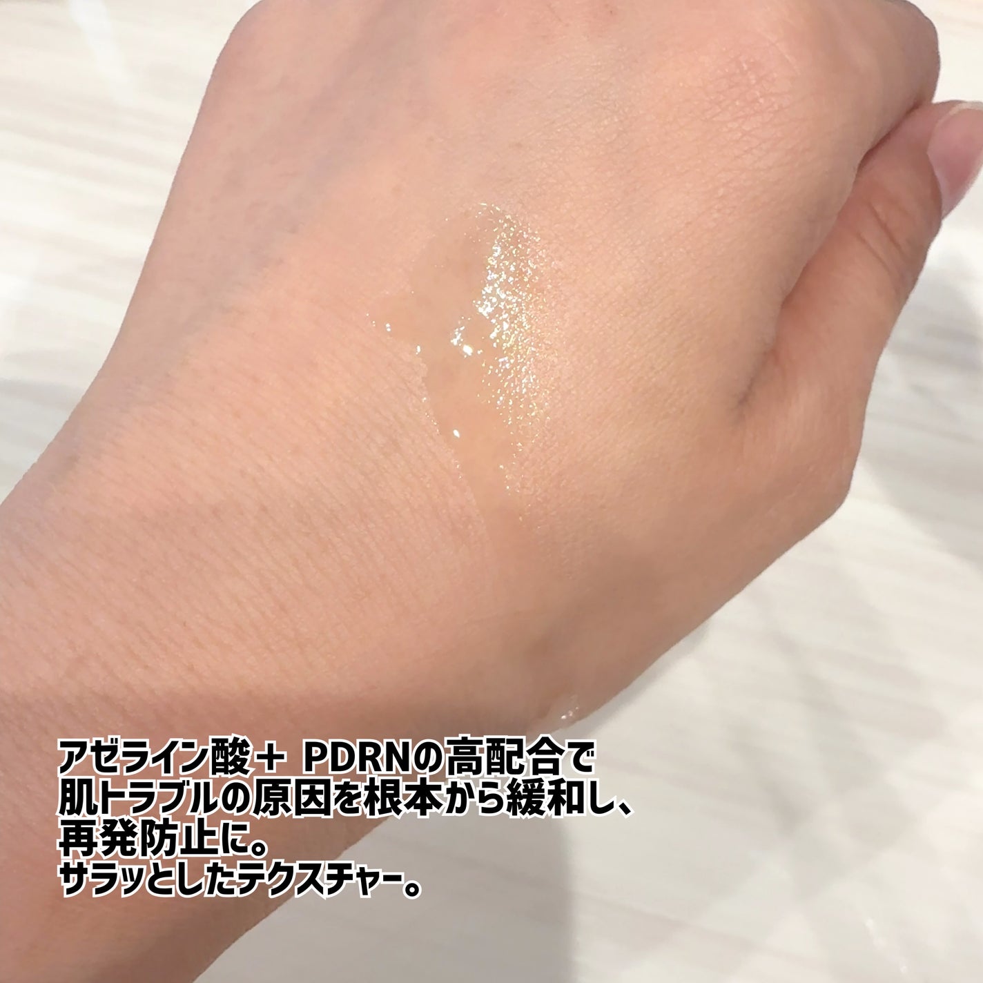 ダーマアンサーアゼライン酸ミントアンプル/CNP Laboratory/美容液を使ったクチコミ(2枚目)