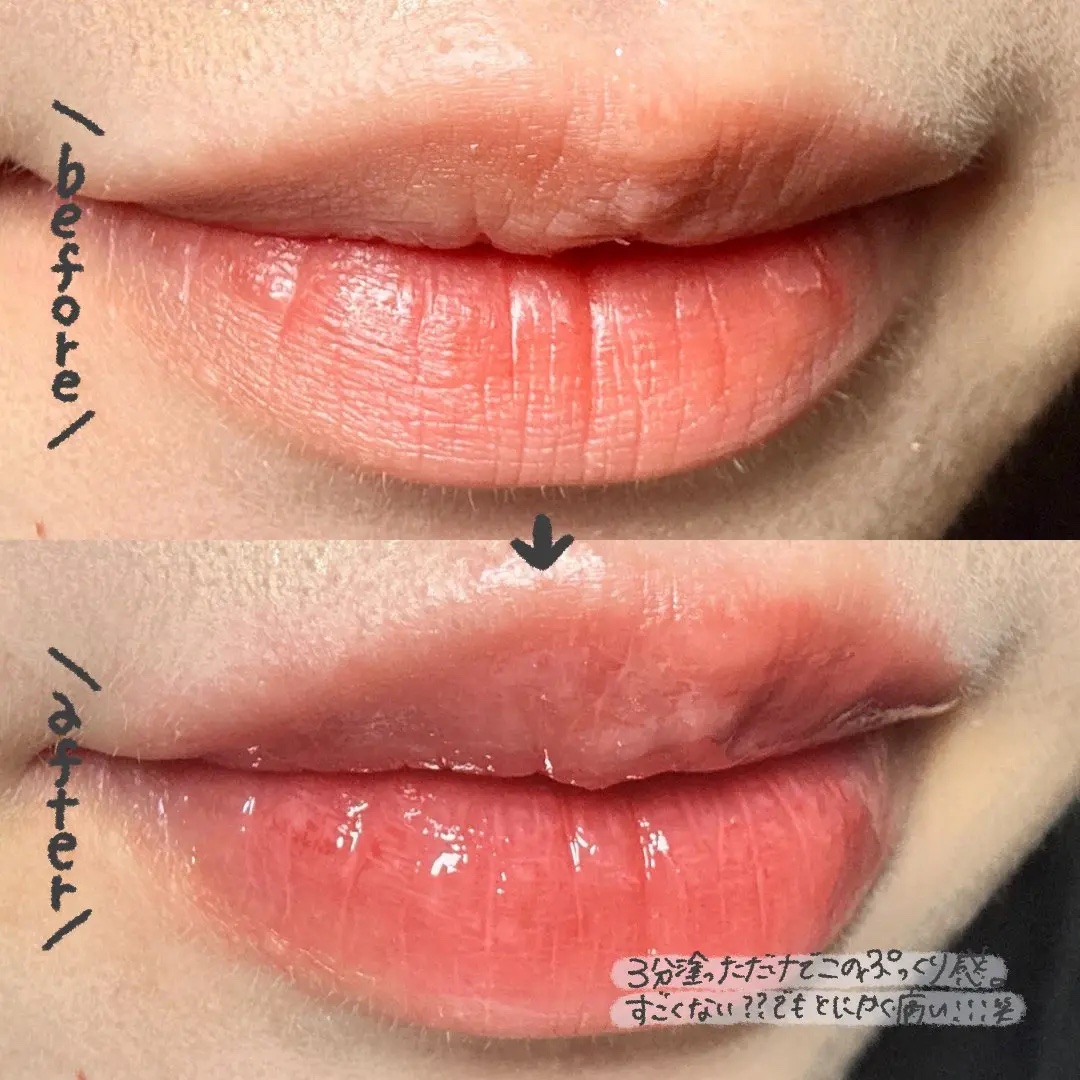 ボリュームリッププランパー/BANILA CO/リッププランパーを使ったクチコミ（2枚目）