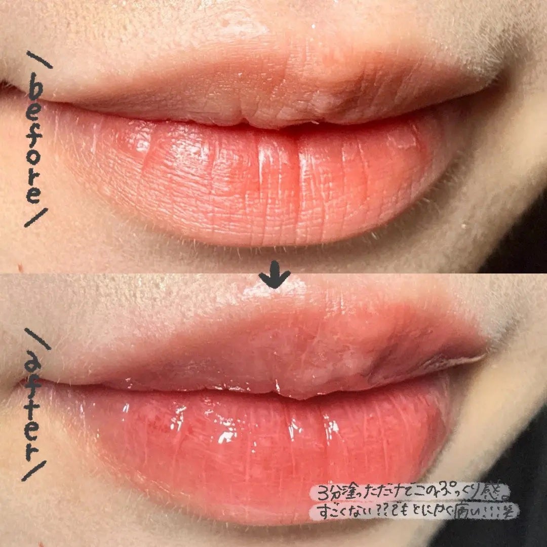 ボリュームリッププランパー/BANILA CO/リッププランパーを使ったクチコミ(2枚目)