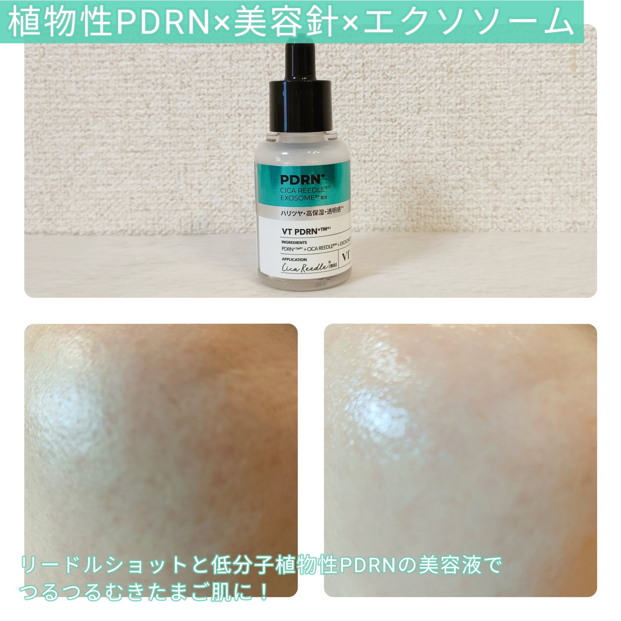 リードルS PDRN+ セラム/VT/美容液を使ったクチコミ（2枚目）