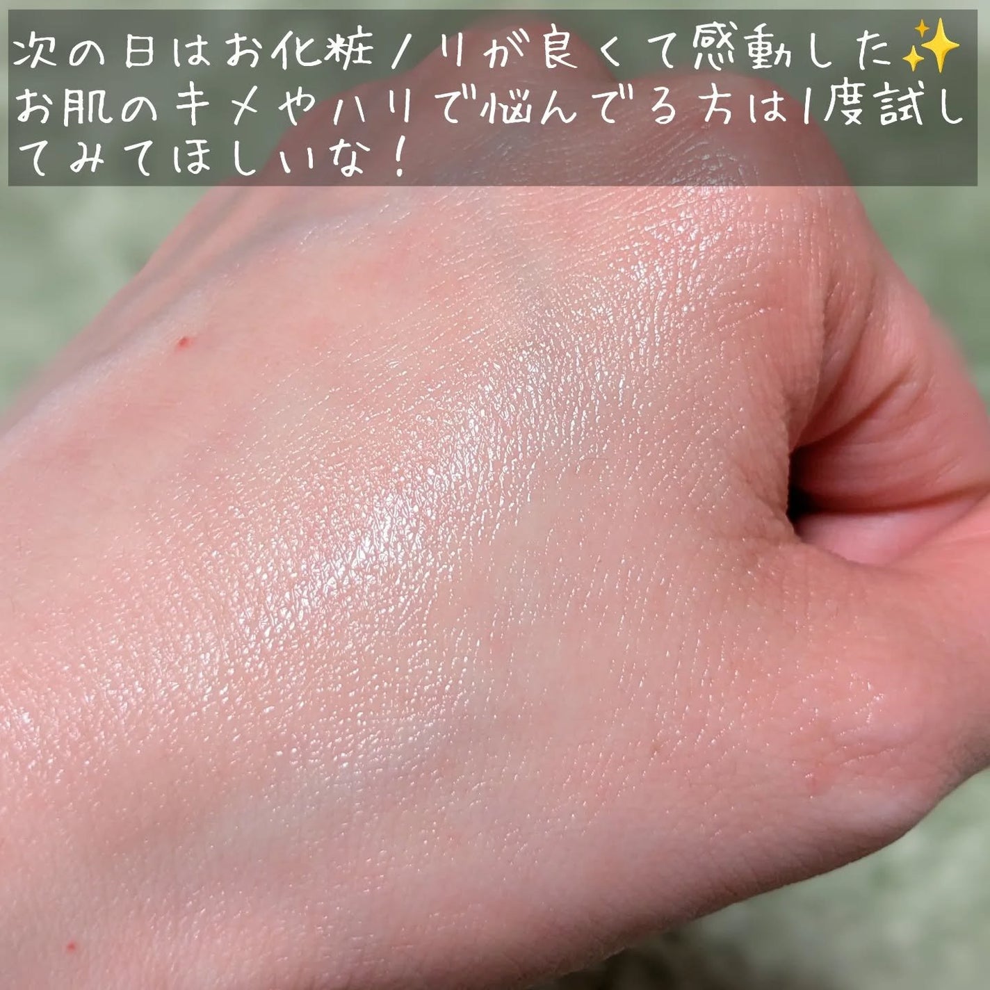 PDRNボリュームショットアンプル/CHARDE/美容液を使ったクチコミ(6枚目)