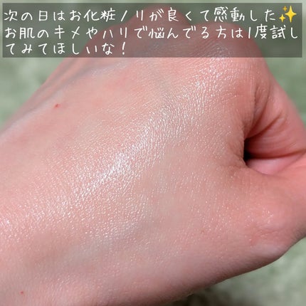 PDRNボリュームショットアンプル/CHARDE/美容液を使ったクチコミ(6枚目)