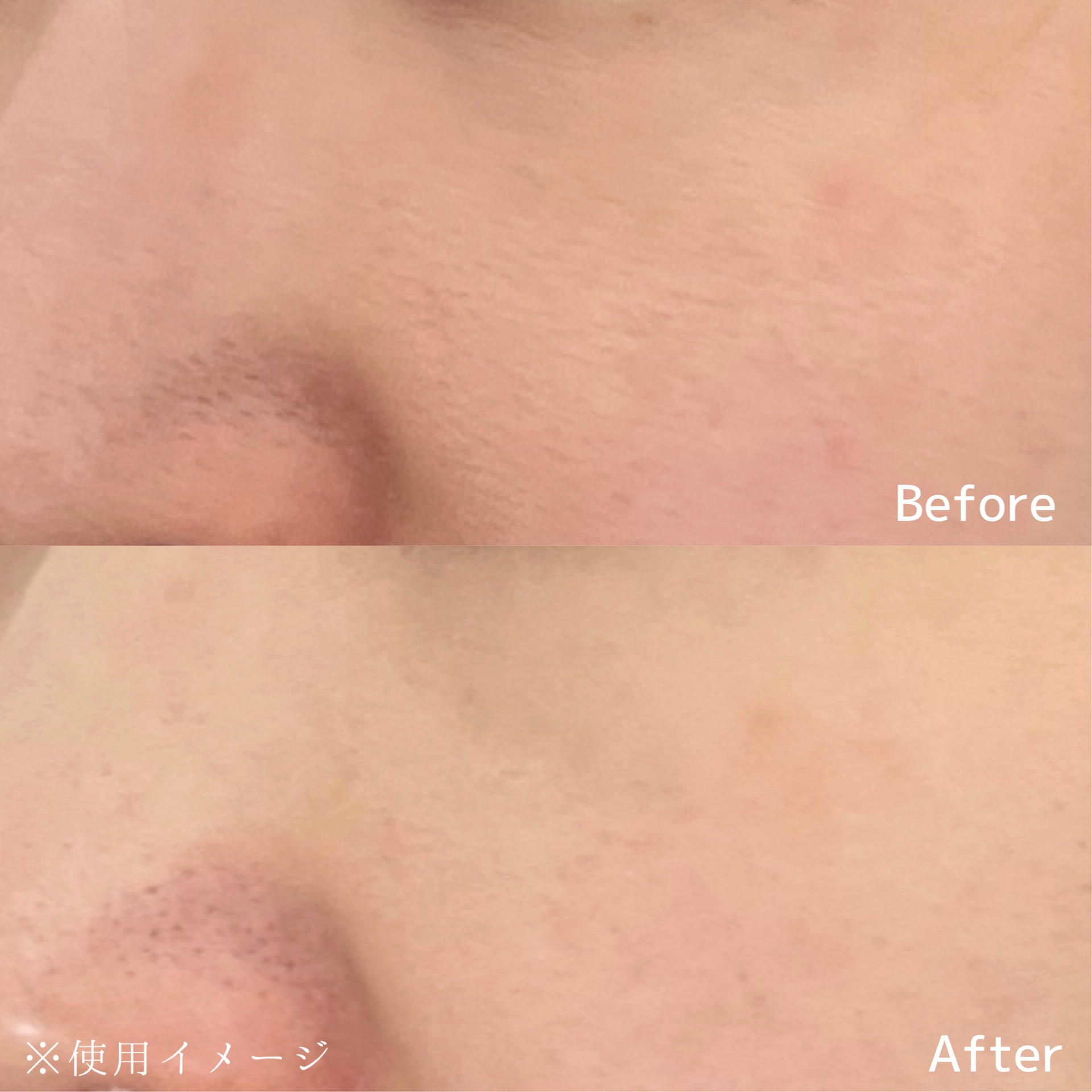 AZケア クレンジングオイル/VT/オイルクレンジングを使ったクチコミ（3枚目）