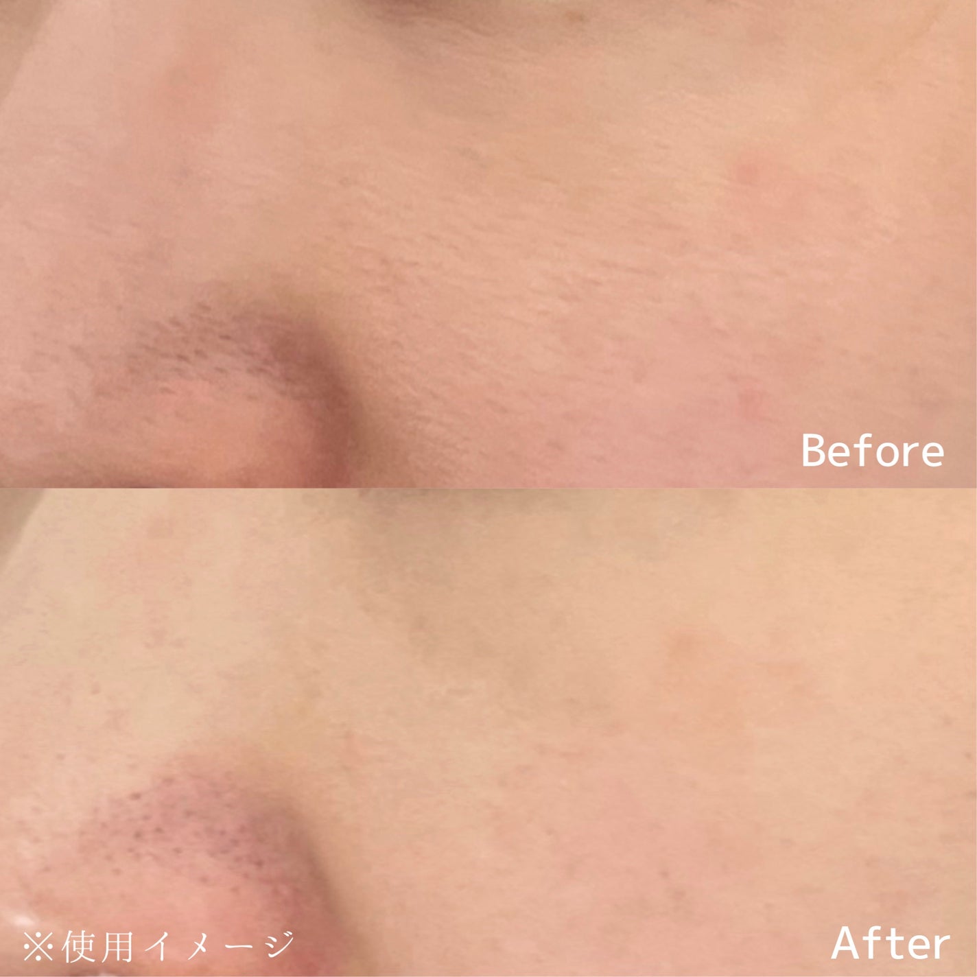 AZケア クレンジングオイル/VT/オイルクレンジングを使ったクチコミ(3枚目)