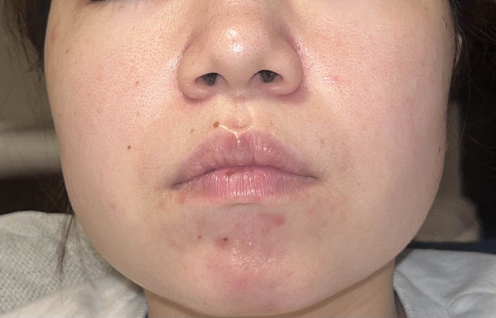 高品位「スクワラン」/HABA/フェイスオイルを使ったクチコミ（2枚目）