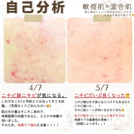 薬用しみ集中対策 プレミアム美容液/メラノCC/美容液を使ったクチコミ(2枚目)