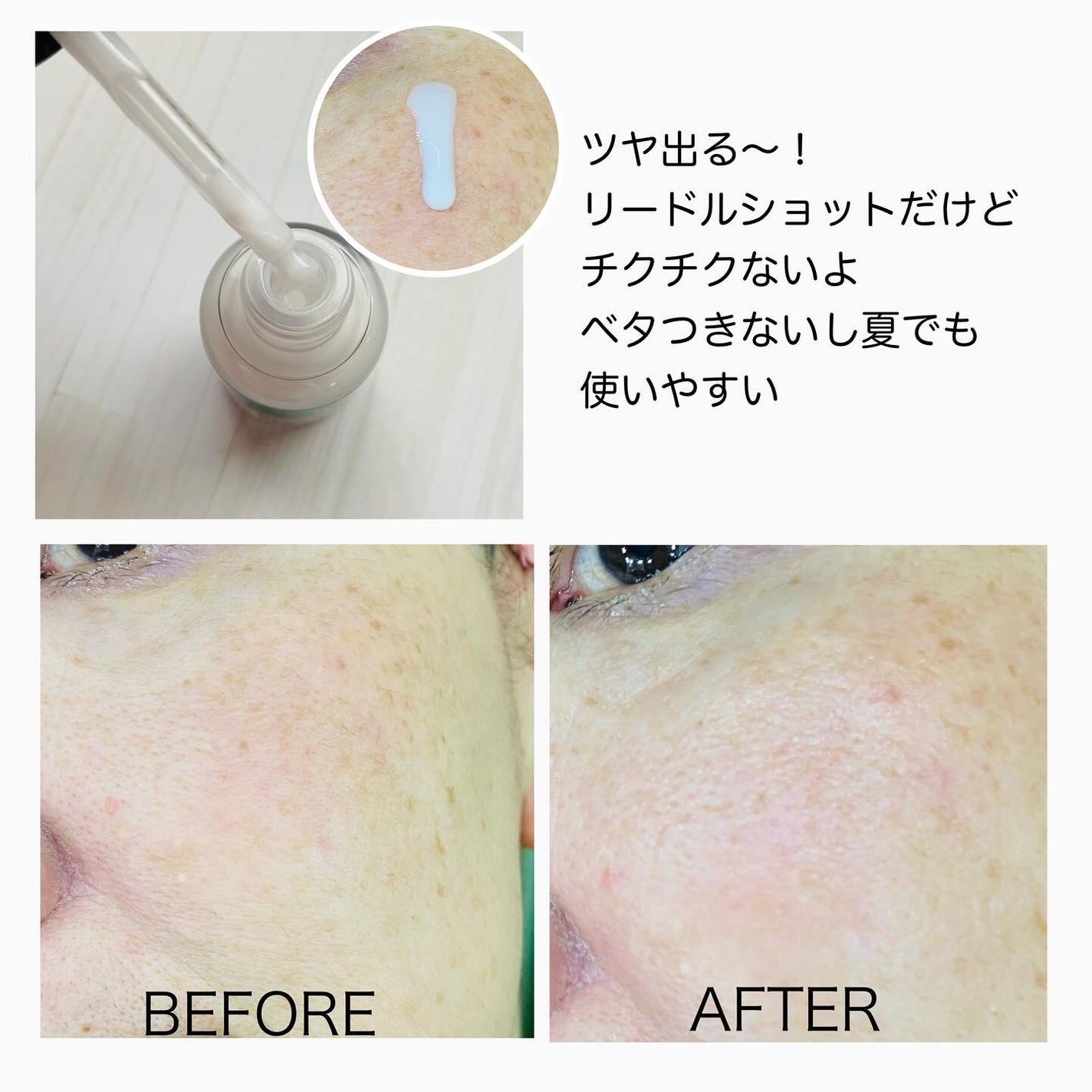 リードルS PDRN+ セラム/VT/美容液を使ったクチコミ(3枚目)