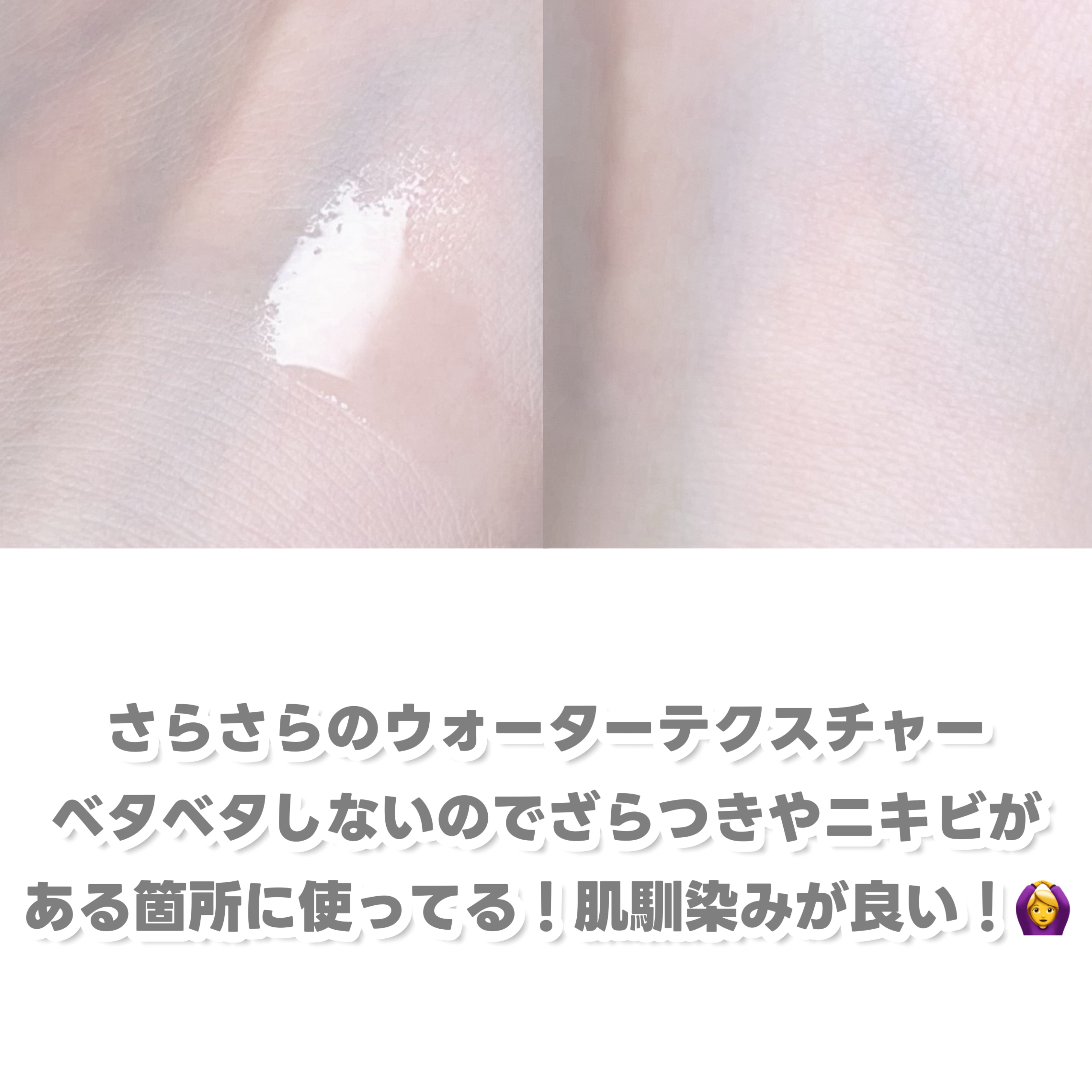 ダーマアンサーアゼライン酸ミントアンプル/CNP Laboratory/美容液を使ったクチコミ（3枚目）