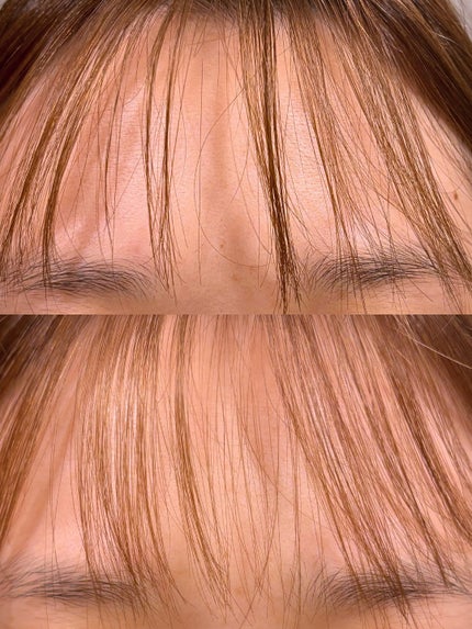 プルント マルチケアドライシャンプー フローラルシャワー/Purunt./ドライシャンプーを使ったクチコミ(2枚目)