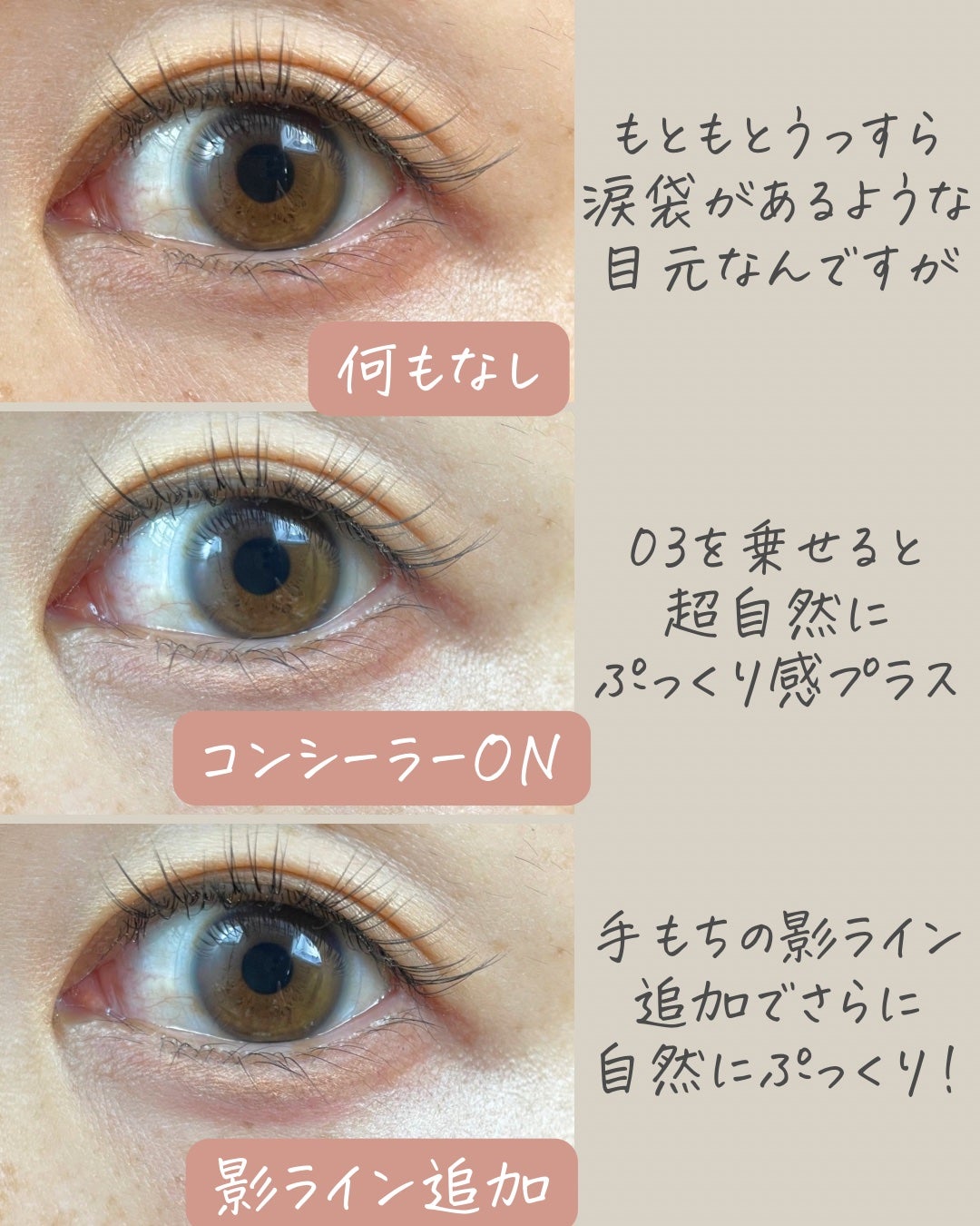 アイバッグコンシーラー/キャンメイク/ペンシルコンシーラーを使ったクチコミ(6枚目)