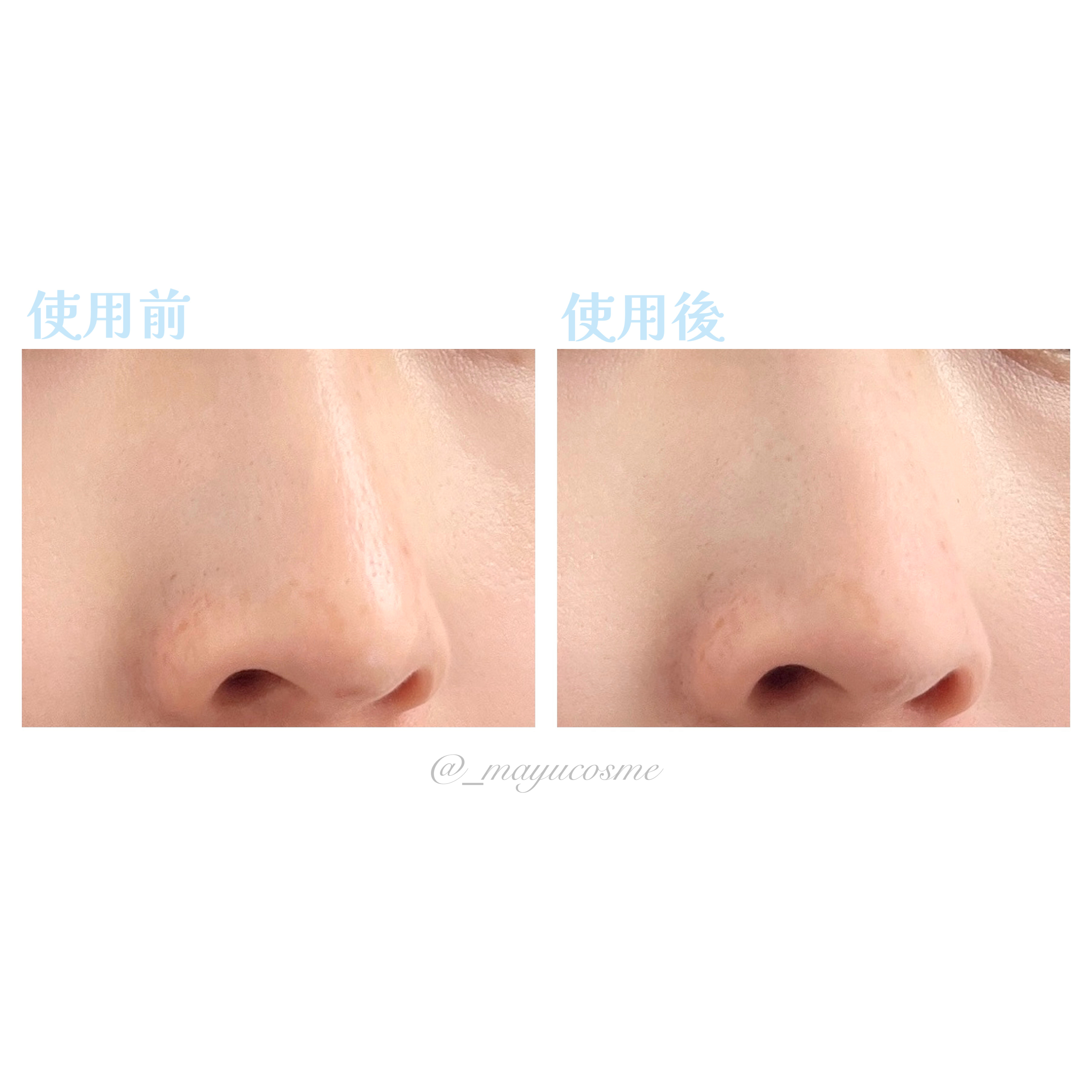 エテュセ ポアレスプライマー クール/ettusais/化粧下地を使ったクチコミ（3枚目）