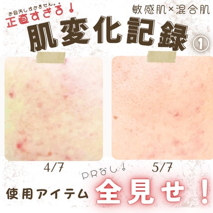 薬用しみ集中対策 プレミアム美容液/メラノCC/美容液を使ったクチコミ(1枚目)