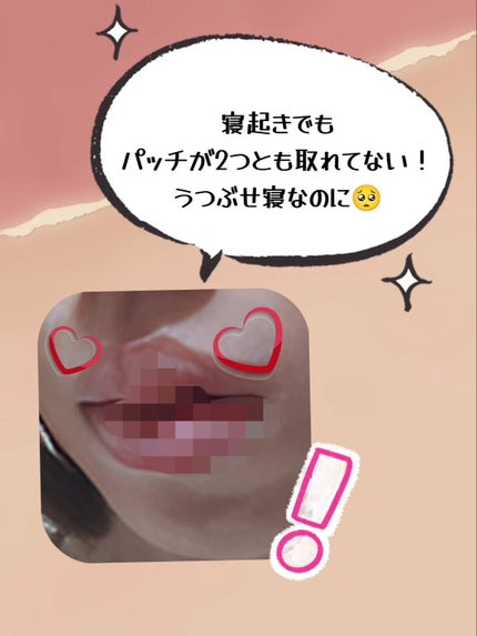 ACマグネシウムパッチ/スノーツープラス/シートマスク・パックを使ったクチコミ(7枚目)