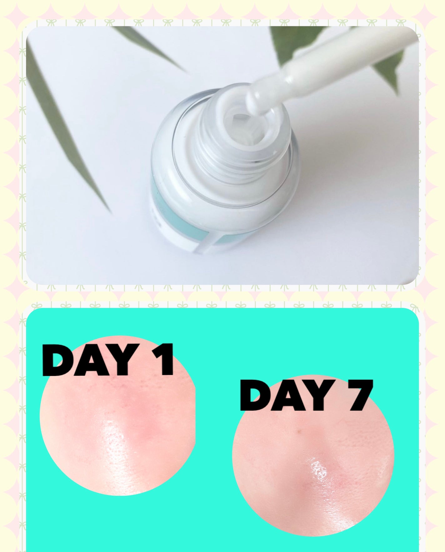 リードルS PDRN+ セラム/VT/美容液を使ったクチコミ(4枚目)