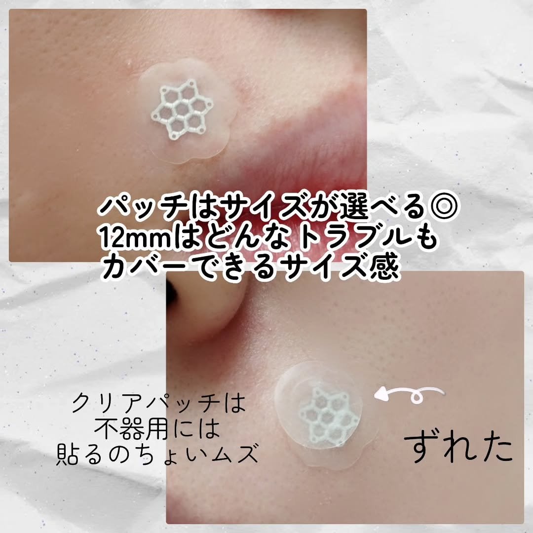 ACマグネシウムパッチ/スノーツープラス/シートマスク・パックを使ったクチコミ(5枚目)