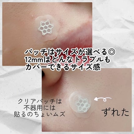 ACマグネシウムパッチ/スノーツープラス/シートマスク・パックを使ったクチコミ(5枚目)