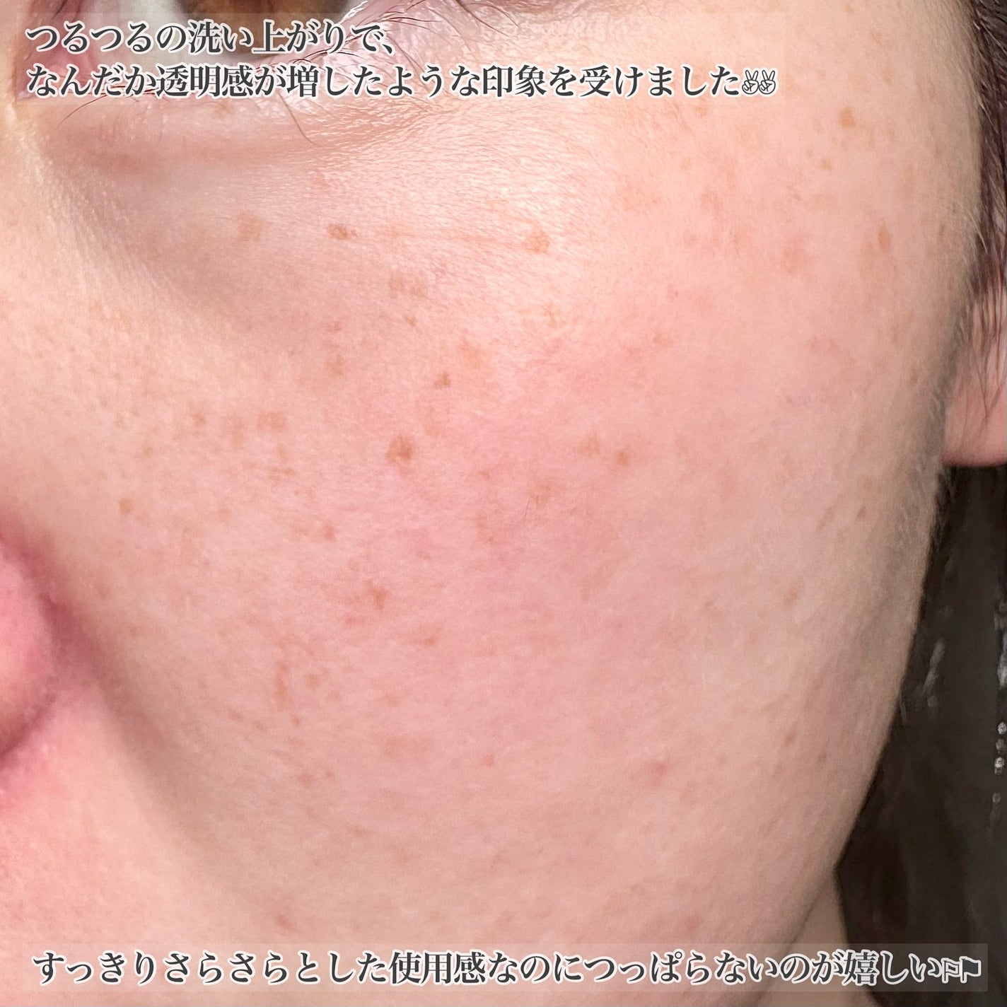 ブレミッシュ 酵素 洗顔パウダー/PAPA RECIPE/洗顔パウダーを使ったクチコミ(6枚目)