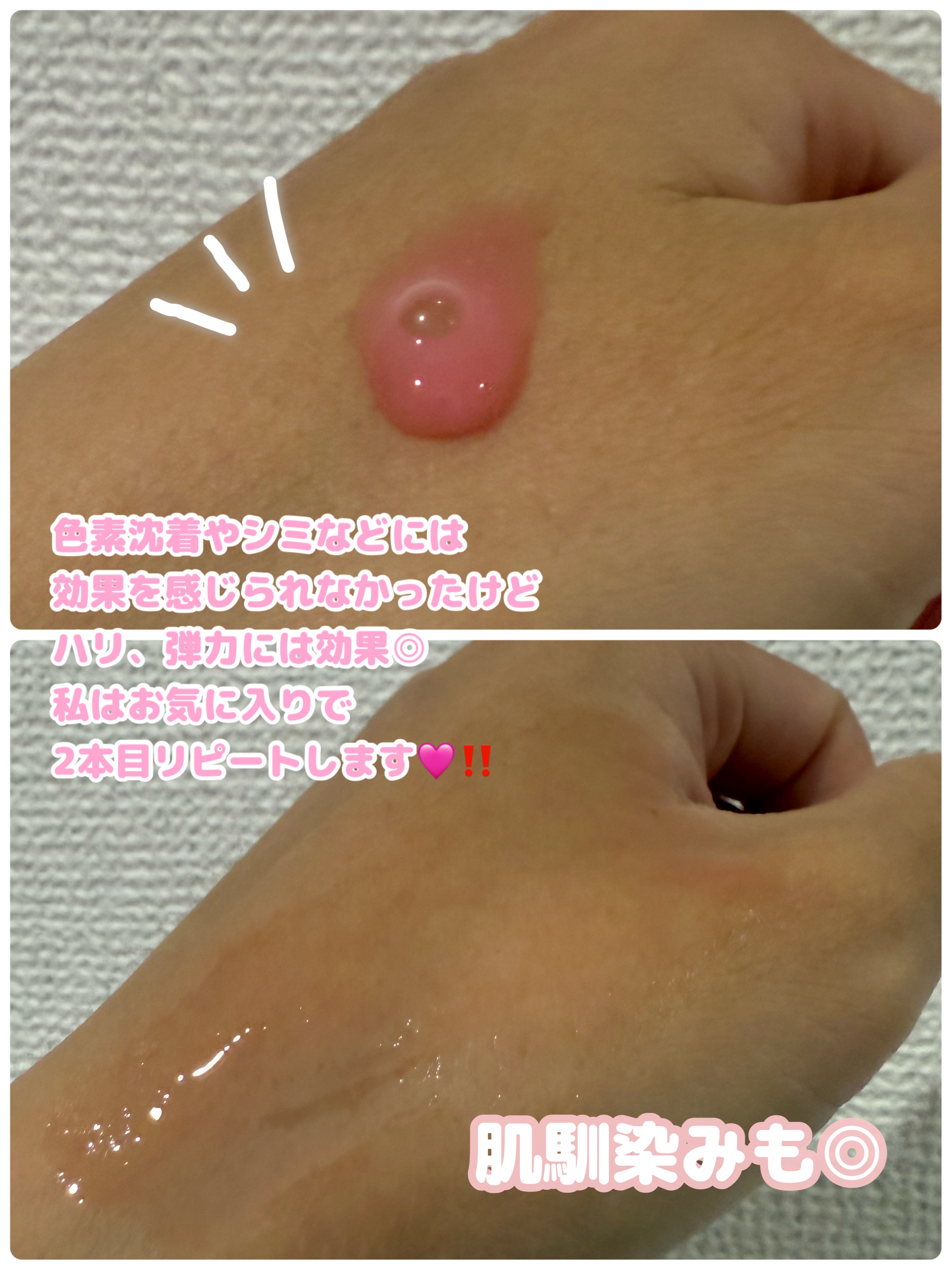 PDRNピンクアンプル PDRN 10,000ppm配合/MEDICUBE/美容液を使ったクチコミ（3枚目）