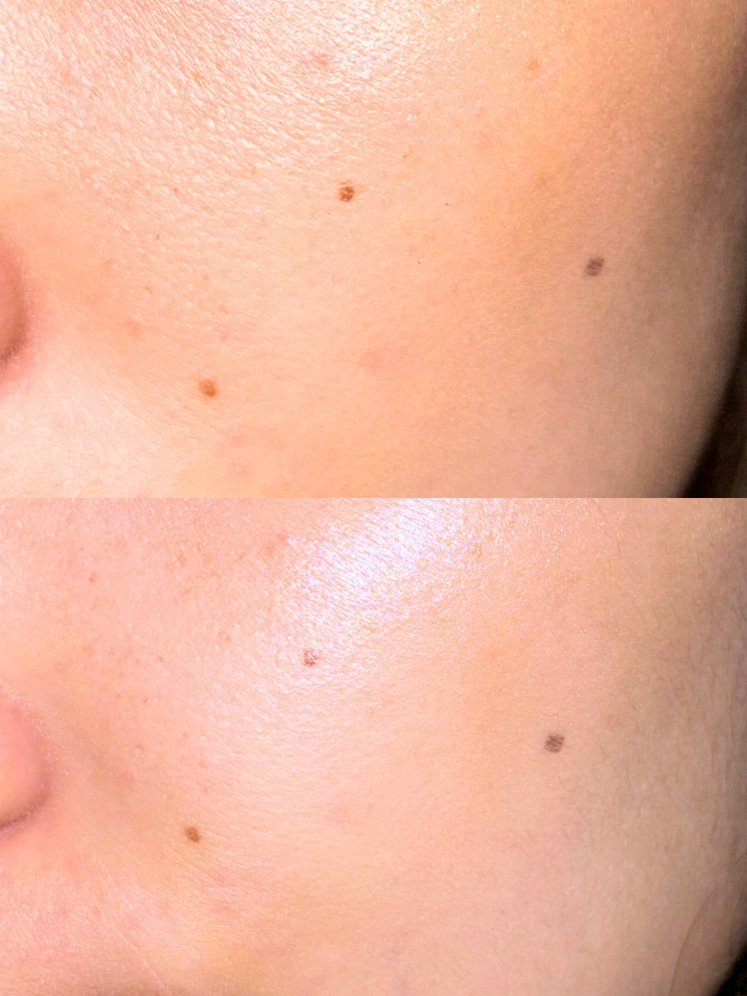 エファクラ ピールケア セラム/ラ ロッシュ ポゼ/美容液を使ったクチコミ（2枚目）