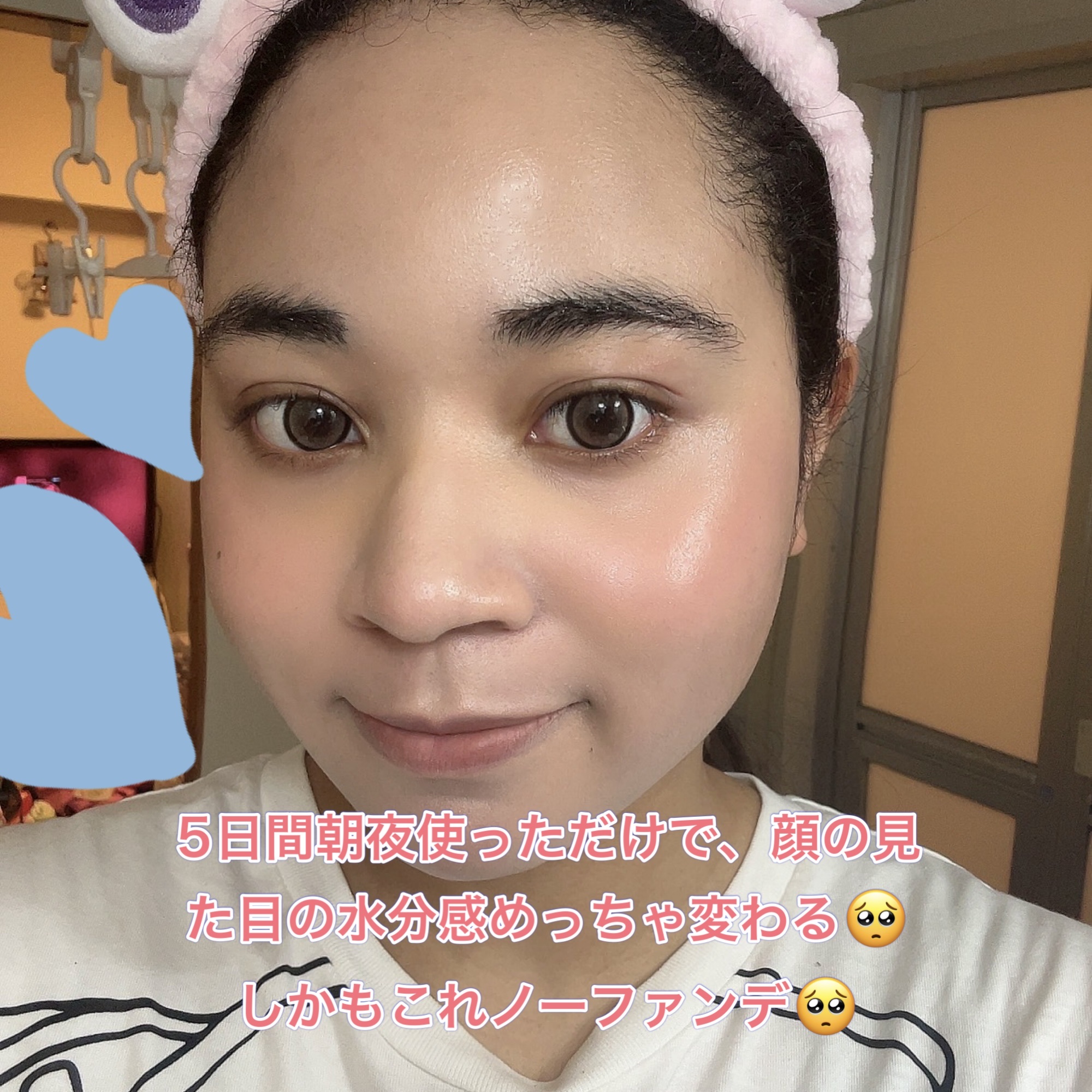 リードルS PDRN+ セラム/VT/美容液を使ったクチコミ（3枚目）