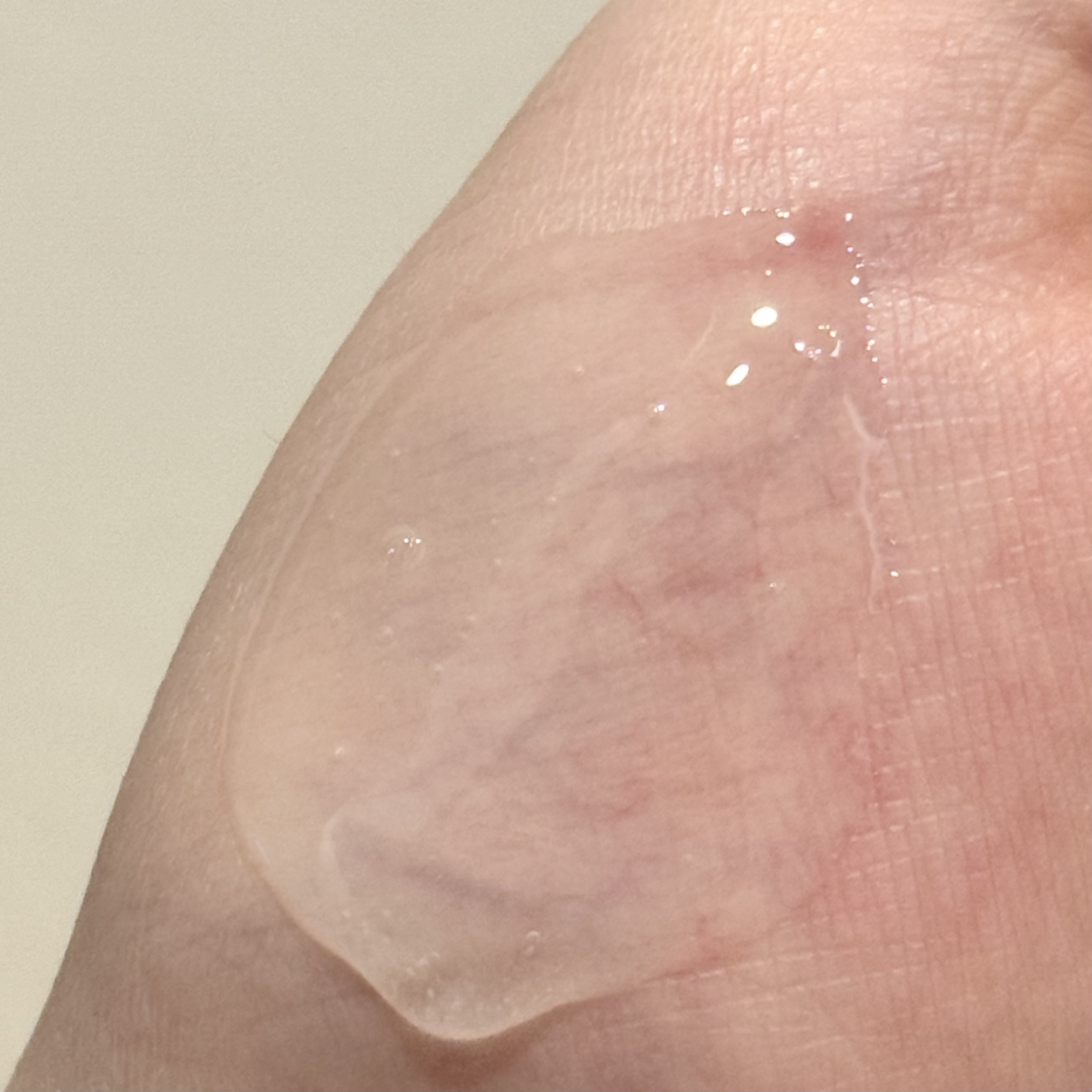 洗い流す美容液 SKIN CLINIC(スキンクリニック)/ICLIONE/美容液を使ったクチコミ（3枚目）