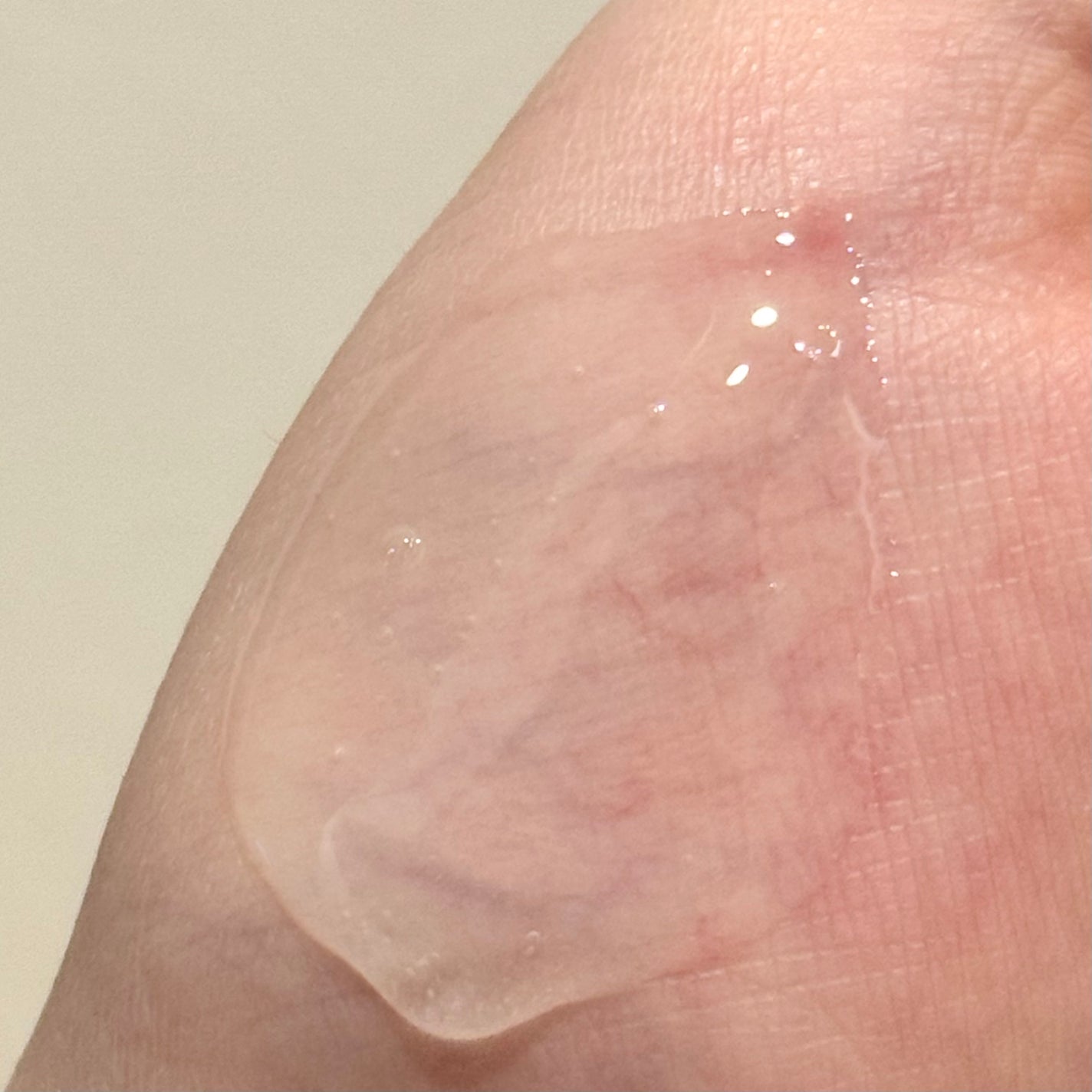 洗い流す美容液 SKIN CLINIC(スキンクリニック)/ICLIONE/美容液を使ったクチコミ(3枚目)