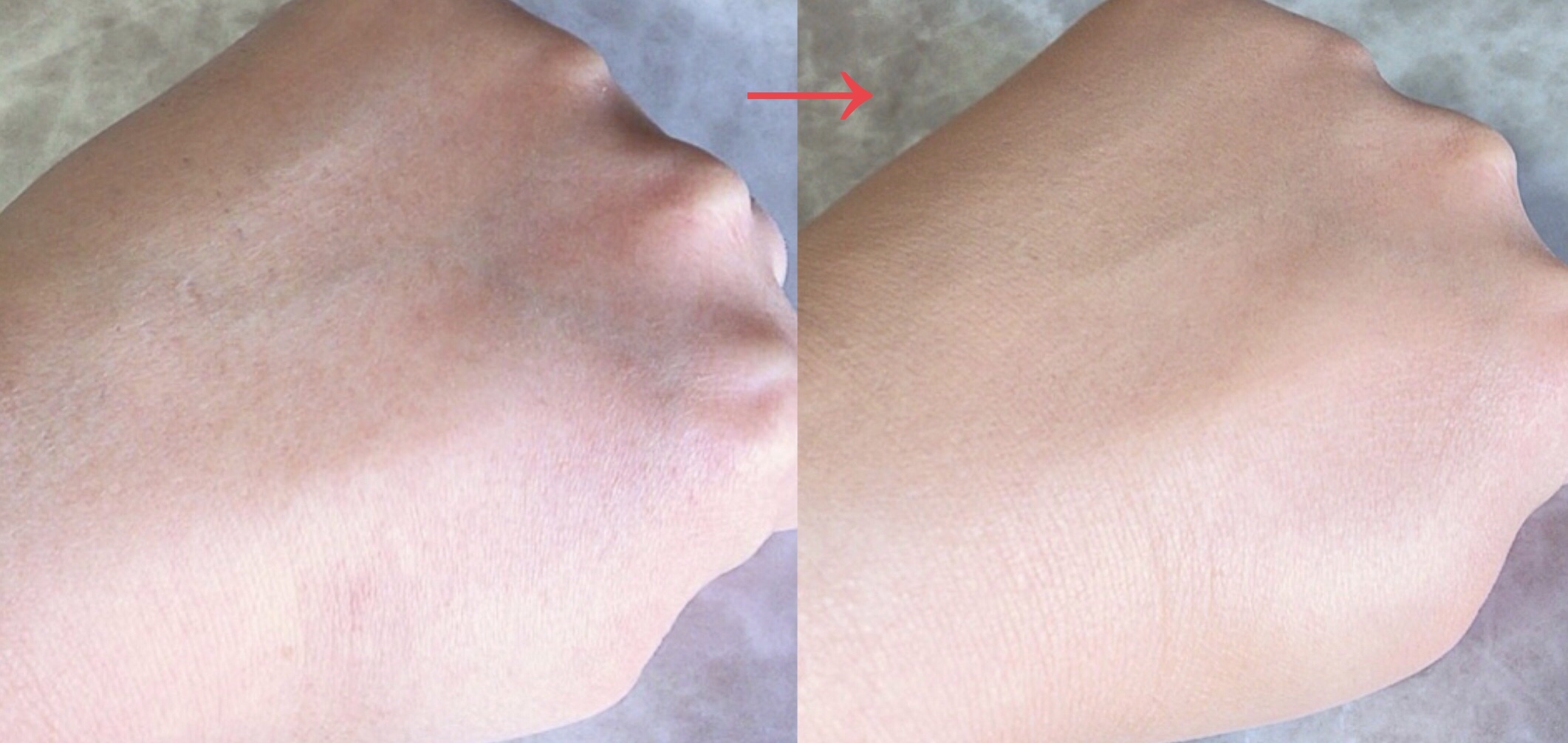 モイストラボ　ハイカバー薬用美白BBクリーム/Moist Labo/BBクリームを使ったクチコミ（3枚目）