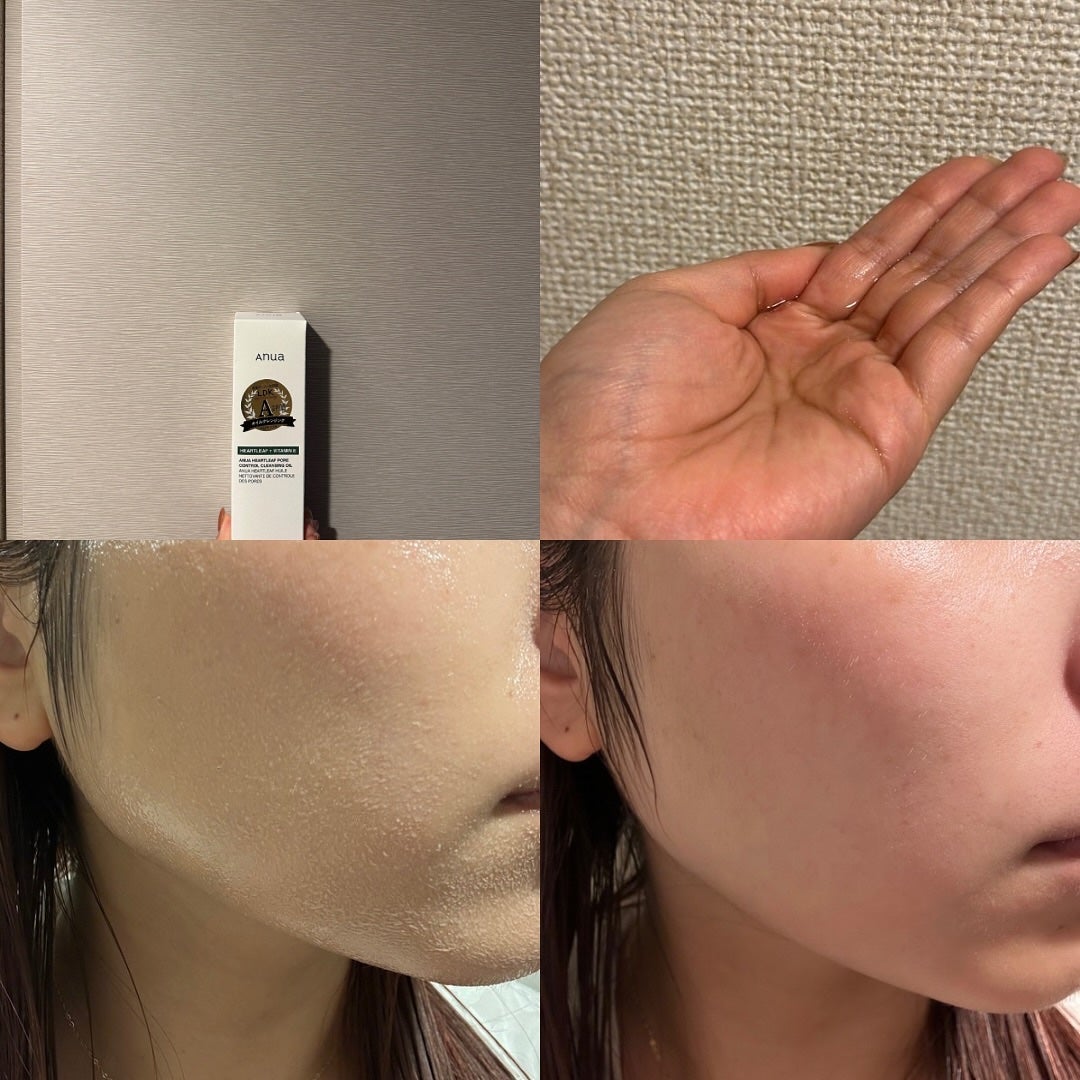 ドクダミ ポアコントロールクレンジングオイル/Anua/オイルクレンジングを使ったクチコミ(2枚目)