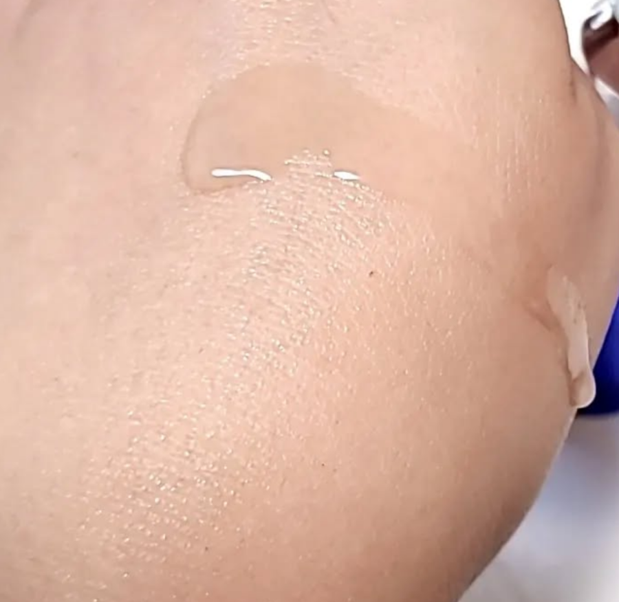 トランスダーマ C/トランスダーマ/美容液を使ったクチコミ(2枚目)