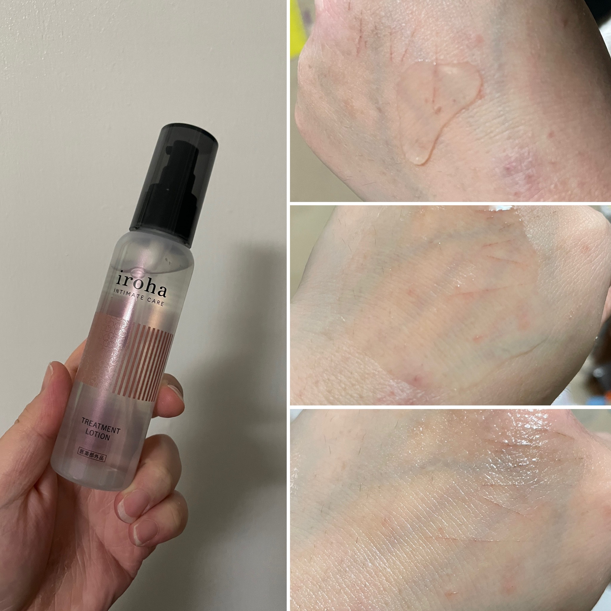 イロハ トリートメントローション/iroha INTIMATE CARE/デリケートゾーンケアを使ったクチコミ（2枚目）