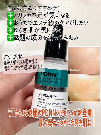 リードルS PDRN+ セラム/VT/美容液を使ったクチコミ(4枚目)