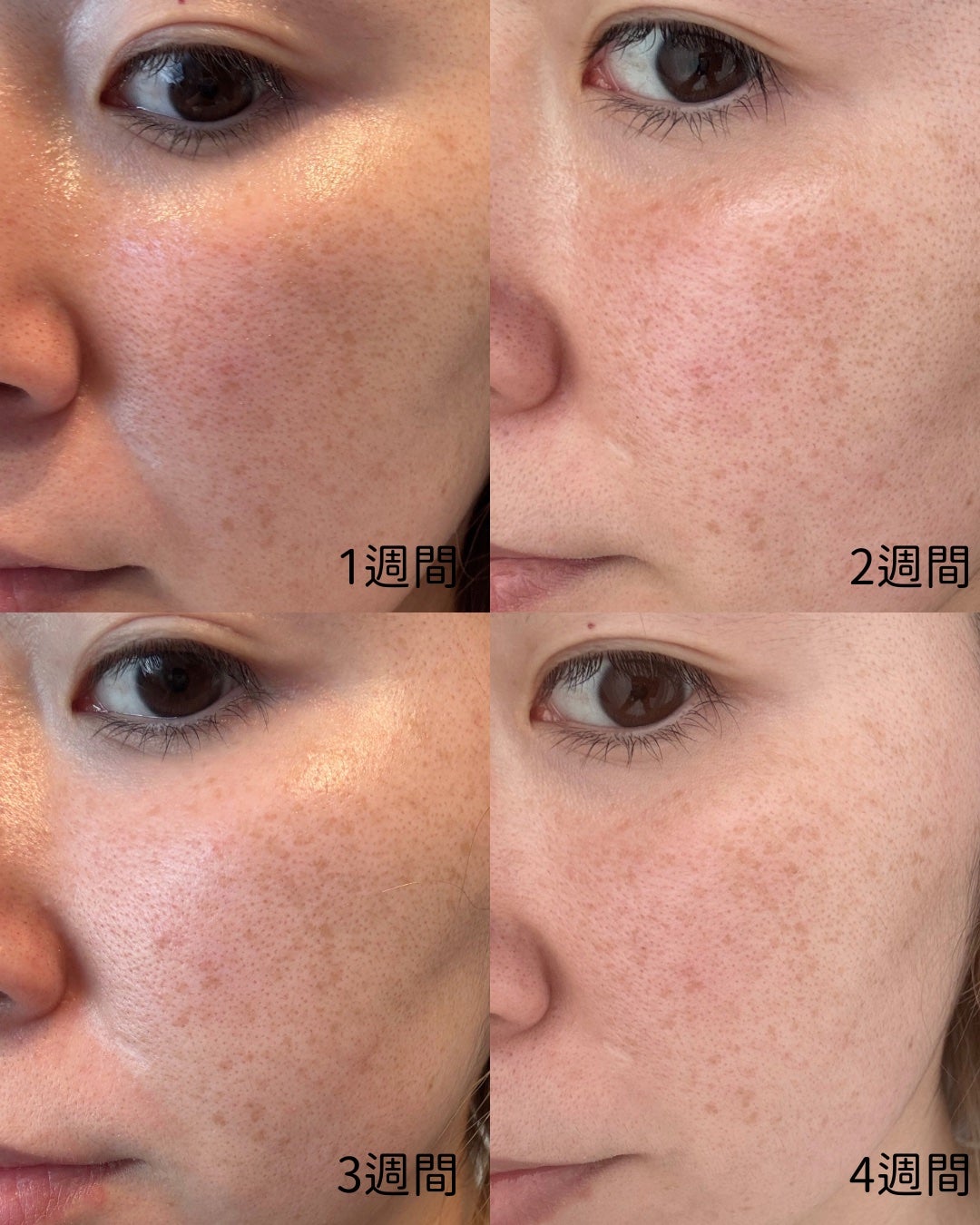 クエスクHQ1セラム/b.glen/美容液を使ったクチコミ(3枚目)