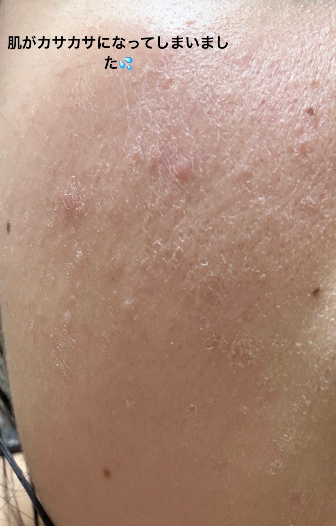 薬用ふわふわな泡洗顔/メンソレータム アクネス/泡洗顔を使ったクチコミ(2枚目)