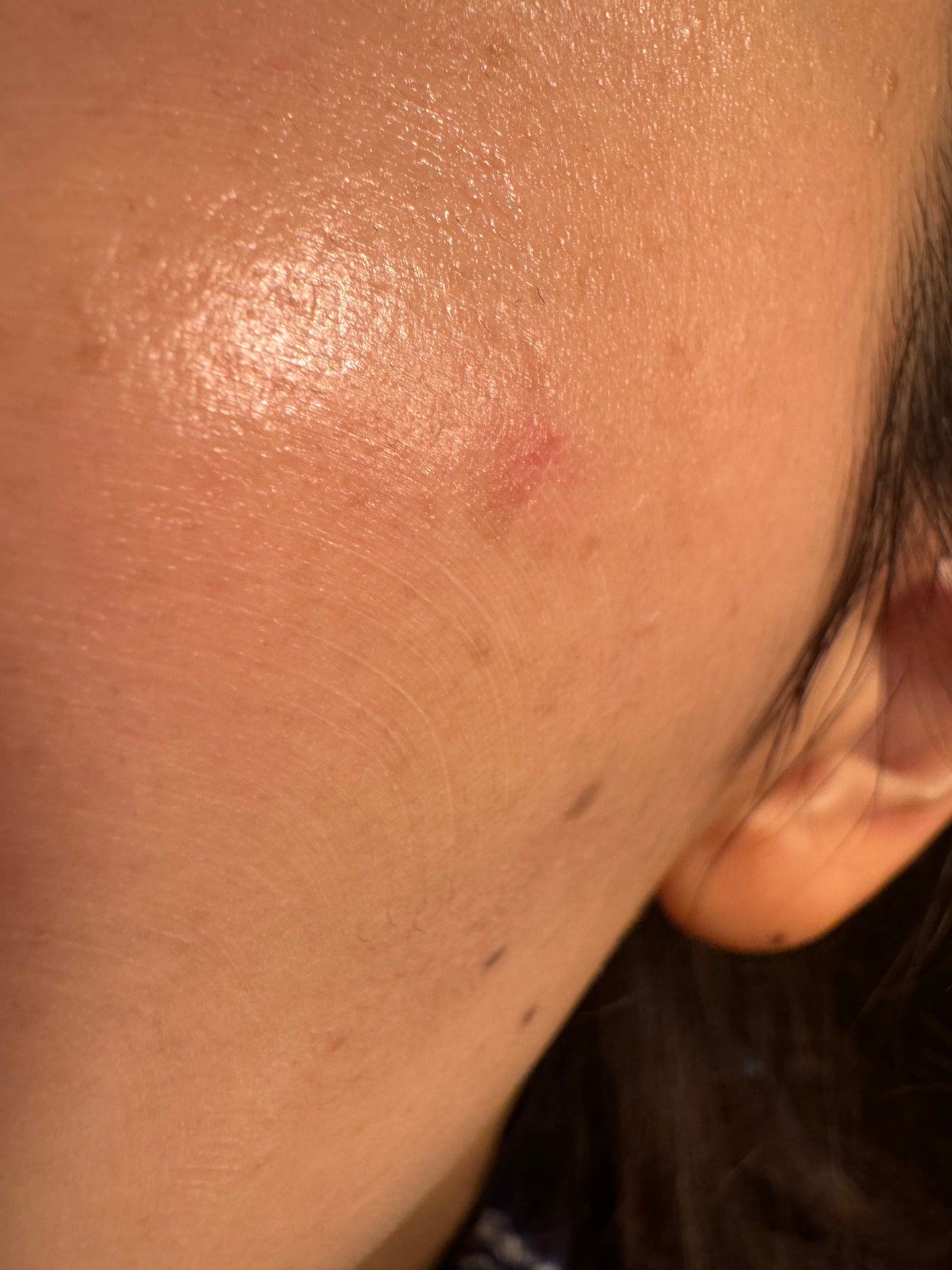 ロングラスティングチップコンシーラー/LUNA/リキッドコンシーラーを使ったクチコミ(2枚目)