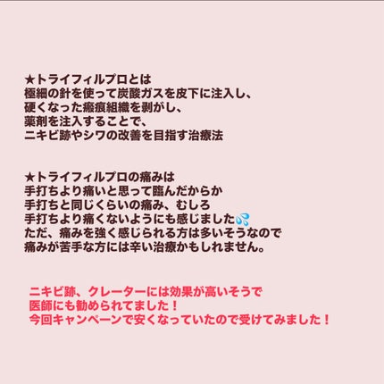 お芋ちゃん|10年以上ニキビに悩む保育士 on LIPS 「受けた7時間後、かさぶたがいくつかある状態です。ポテンツァより..」(4枚目)