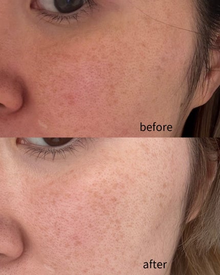 クエスクHQ1セラム/b.glen/美容液を使ったクチコミ(4枚目)