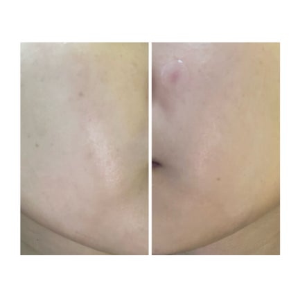 を使ったクチコミ(2枚目)