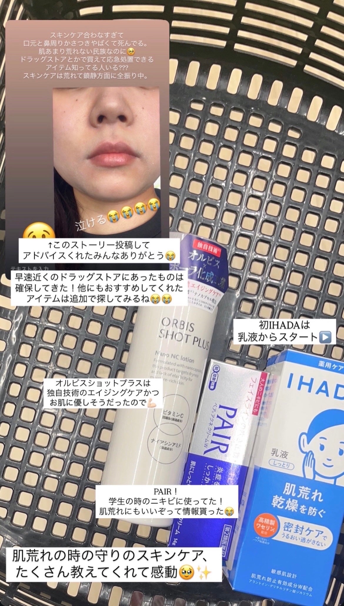 ペアアクネクリームW(医薬品)/ペア/その他を使ったクチコミ(3枚目)