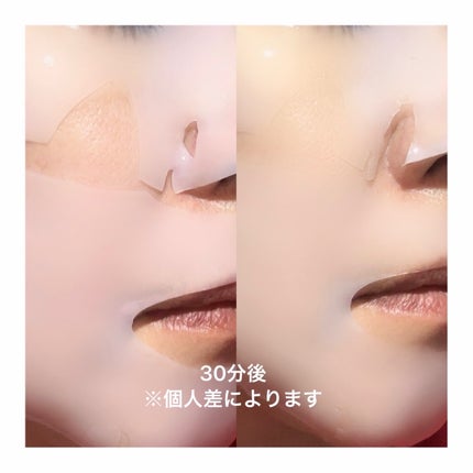 PDRN ハイドロゲルマスクパック/COSNORI/シートマスク・パックを使ったクチコミ(5枚目)