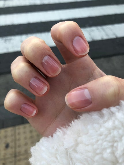 キューティクルオイル/ネイルホリック/ネイルオイル・トリートメントを使ったクチコミ(4枚目)