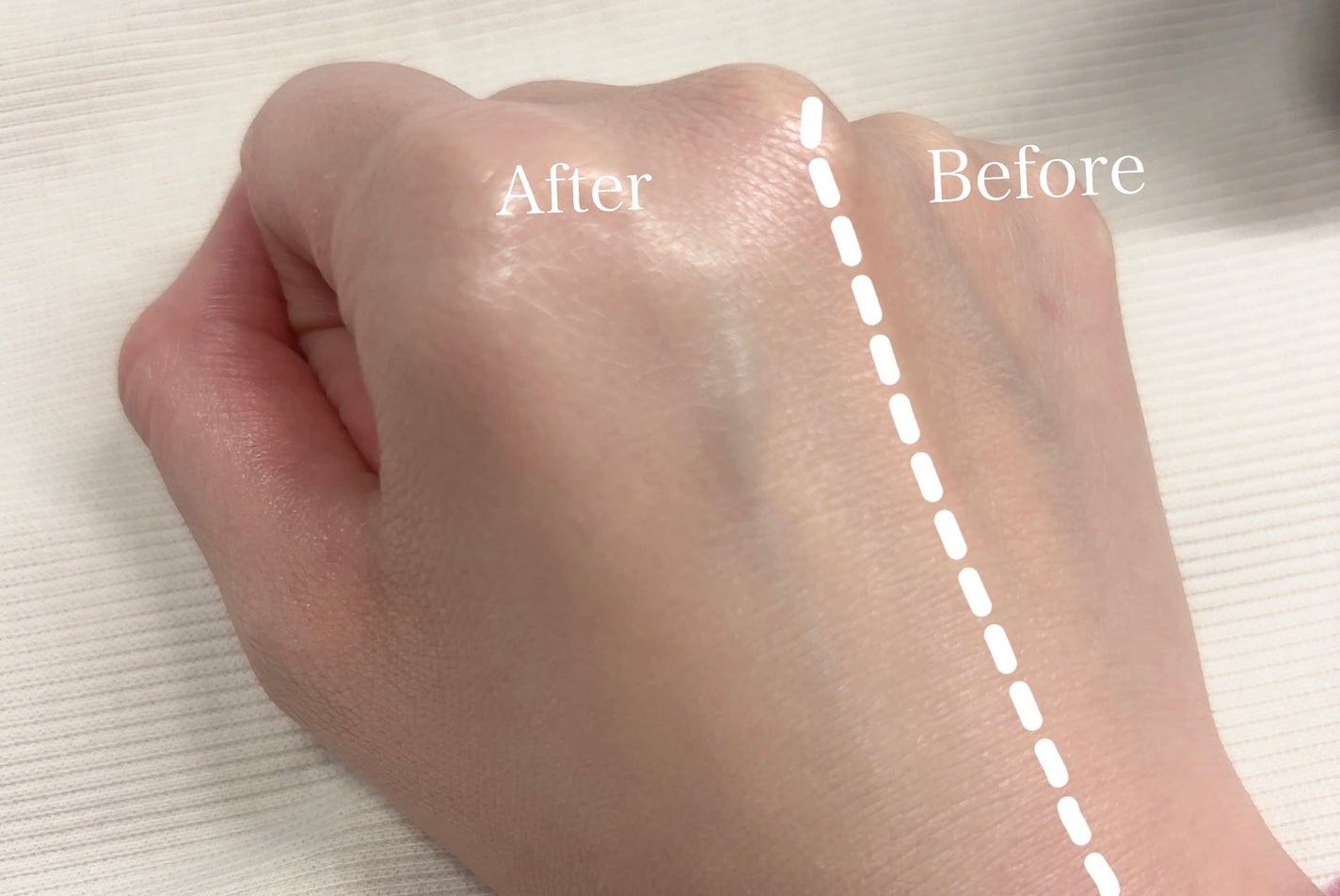 ディロングBBクリーム/RENODERM/BBクリームを使ったクチコミ(4枚目)