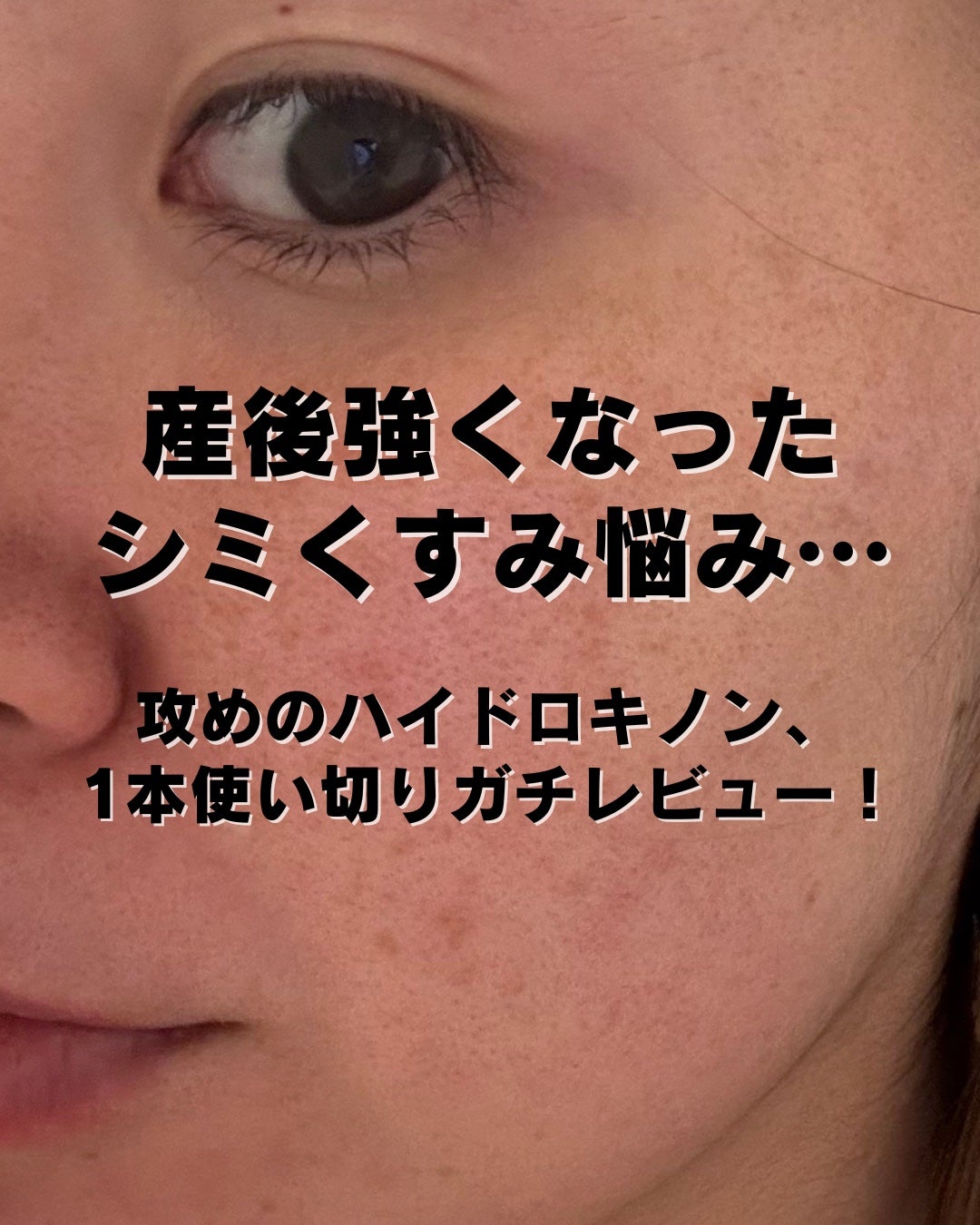 クエスクHQ1セラム/b.glen/美容液を使ったクチコミ(2枚目)