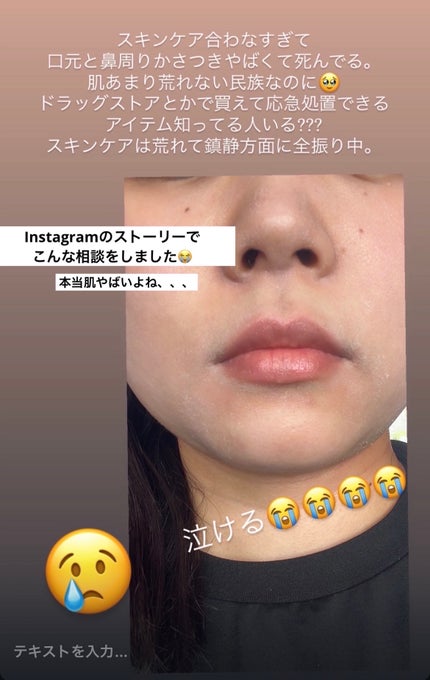 ペアアクネクリームW(医薬品)/ペア/その他を使ったクチコミ(2枚目)