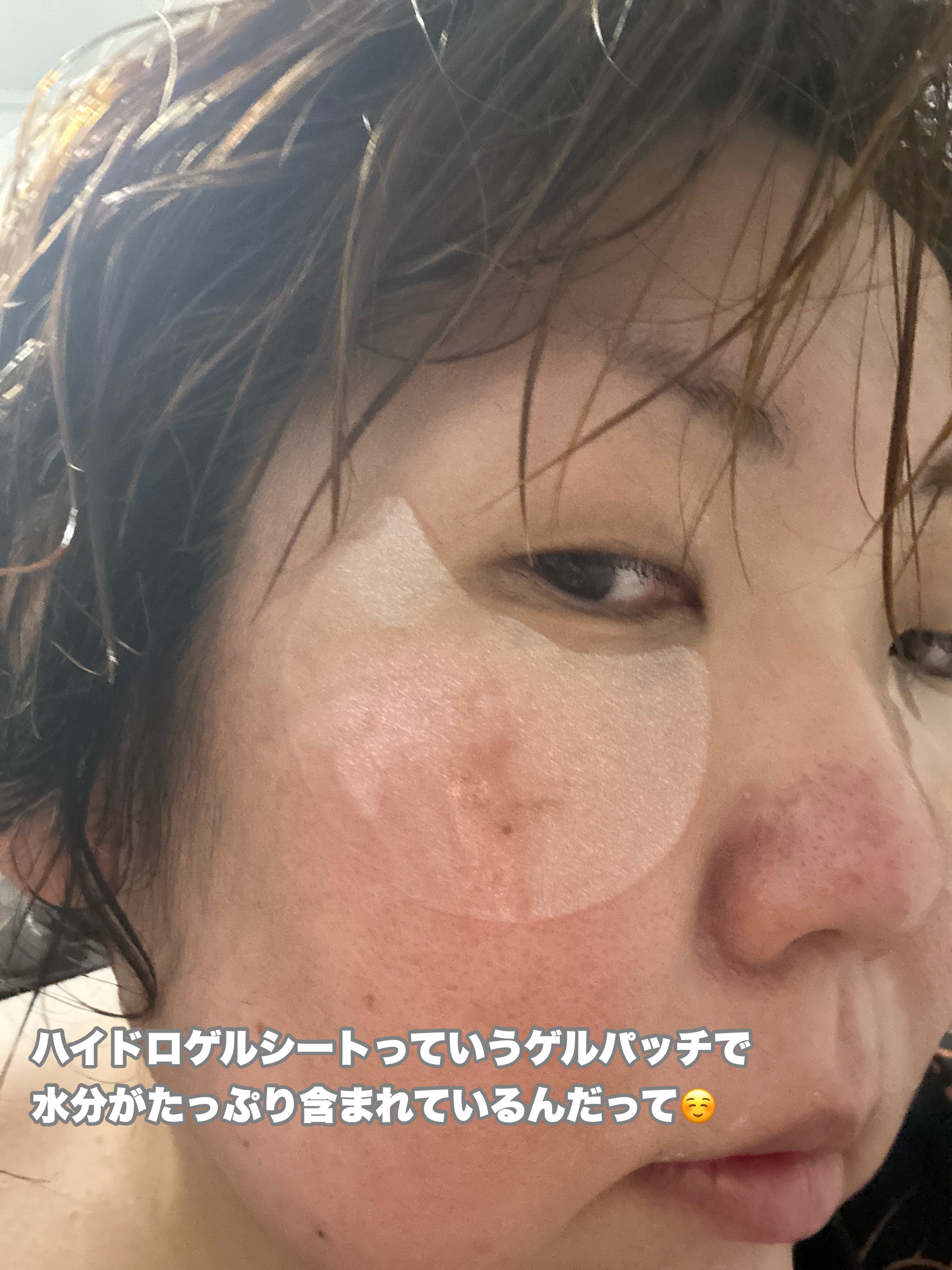 グルタチオンダークゼロトーニングパッチ/SNP/アイケア・アイクリームを使ったクチコミ（2枚目）