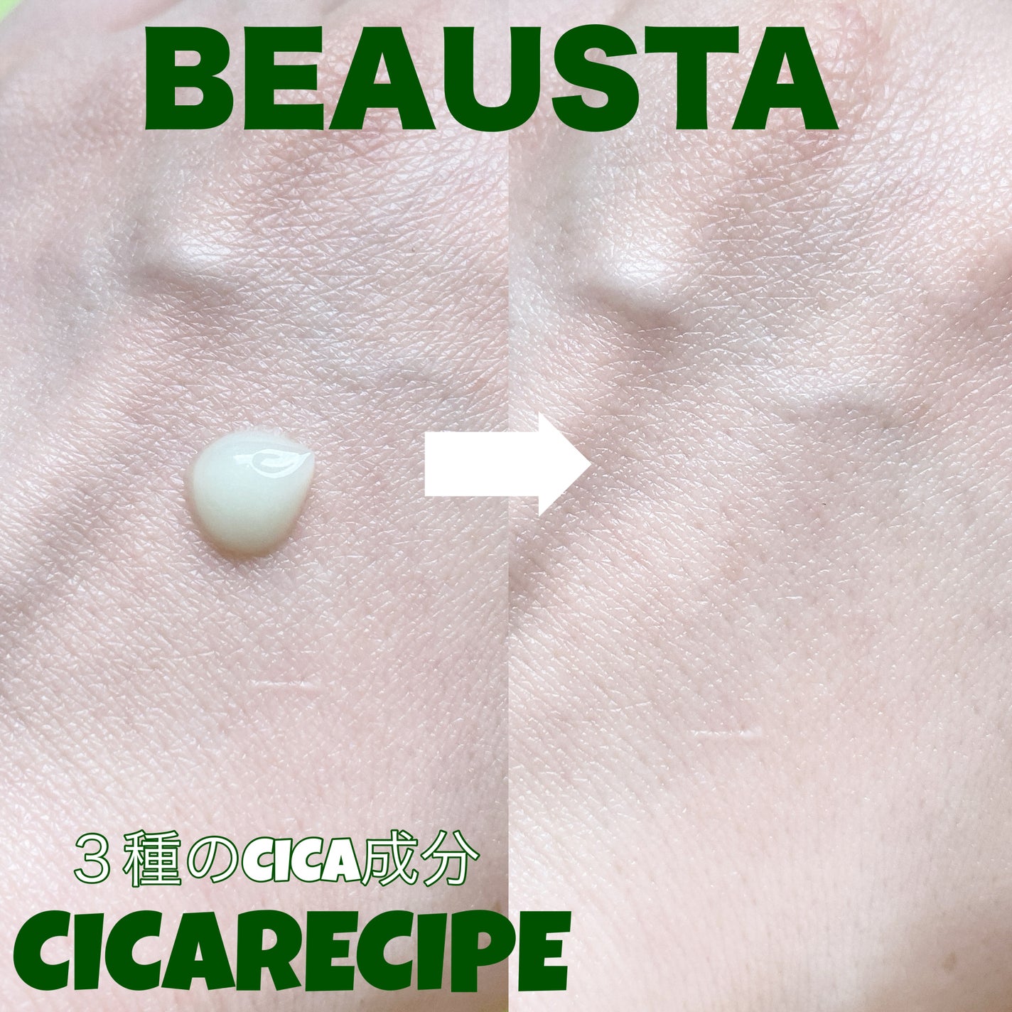 CICA ケアクリーム/BEAUSTA/フェイスクリームを使ったクチコミ(2枚目)