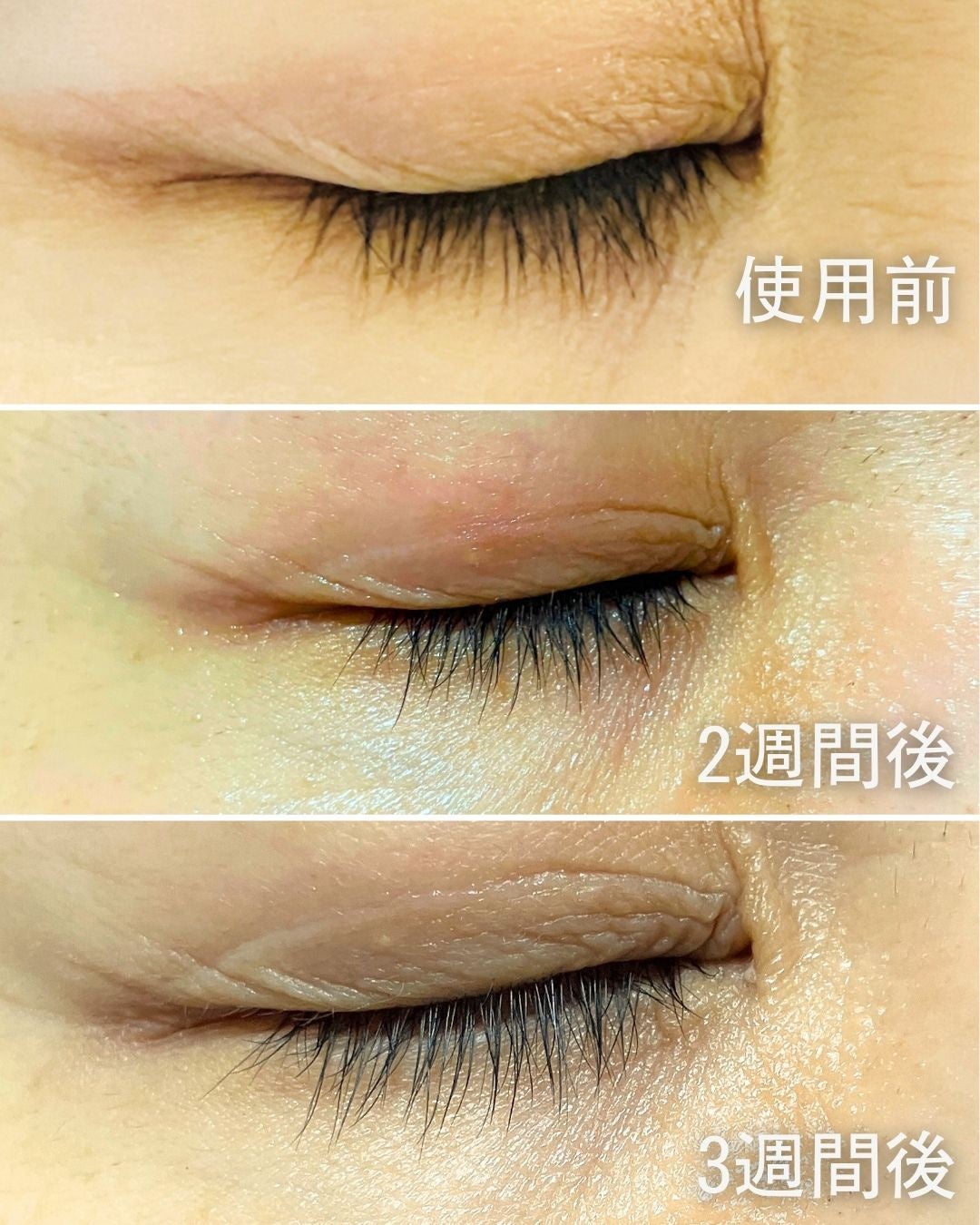 ラッシュアディクト アイラッシュ コンディショニング セラム アドバンス/soaddicted/まつげ美容液を使ったクチコミ(3枚目)