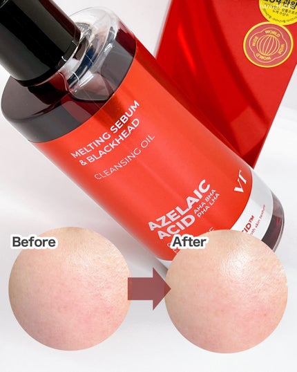 AZケア クレンジングオイル/VT/オイルクレンジングを使ったクチコミ(6枚目)