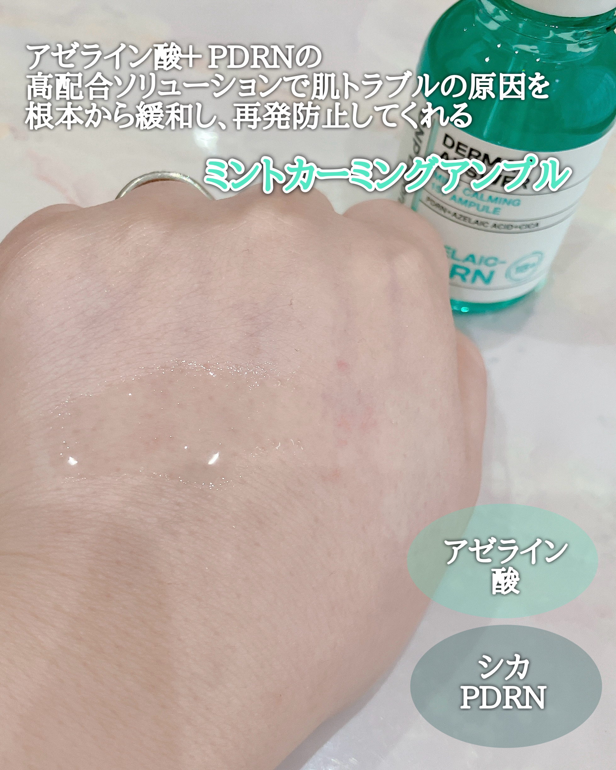 ダーマアンサーアゼライン酸ミントアンプル/CNP Laboratory/美容液を使ったクチコミ（2枚目）